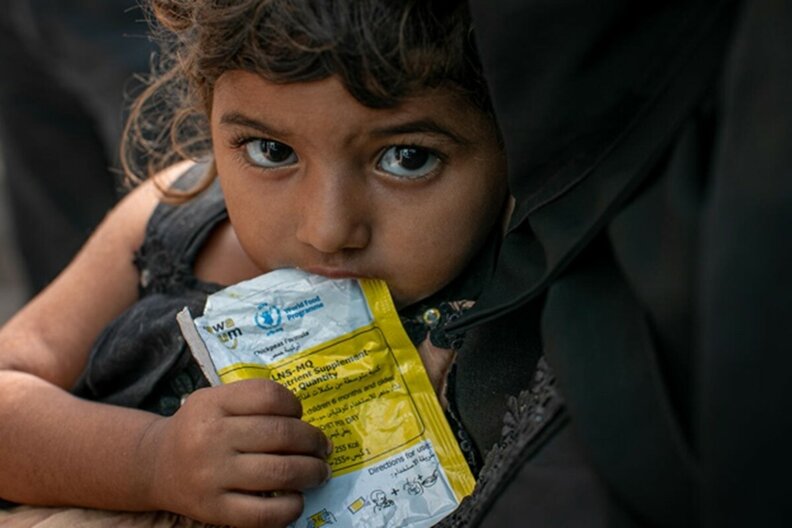 Yémen. Hala, 2 ans, reçoit un complément alimentaire dans une clinique mobile soutenue par le PAM à Mokha.| ©WFP/Hebatallah Munassar