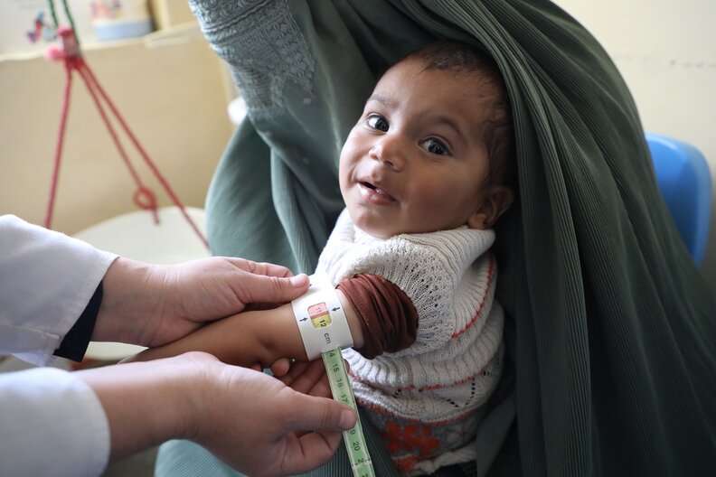 © WFP/Sadeq Naseri - The child in the picture is Samiullah who is two years old and suffers from malnutrition.