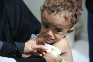 Le PAM est alarmé par les taux de faim et de malnutrition croissants au Yémen.