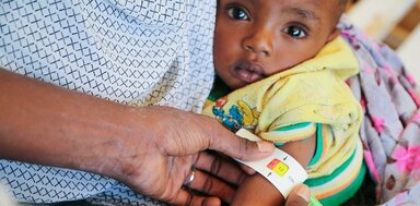 Une petite fille, examinée pour une malnutrition aiguë, regarde l'objectif. 