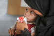 Photo : PAM/Ali Jadallah. Un enfant participant à ses examens médicaux hebdomadaires ou bihebdomadaires avec Action contre la faim (ACF), un partenaire clé du PAM. Palestine, ville de Gaza.