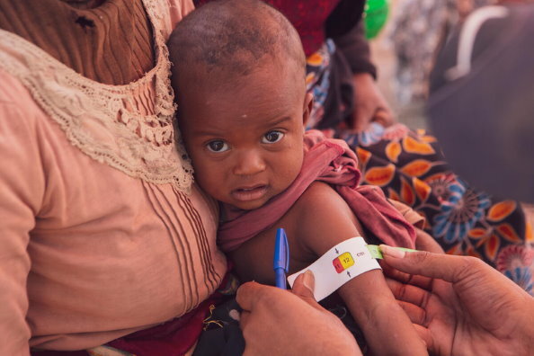 PAM/Tsiory Ny Aina Andriantsoarana, Prise du périmètre brachial d'une petite fille, avant la distribution alimentaire à Ankilimanondro, Madagascar.