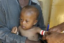 Le Premier Ministre de Madagascar demande du soutien et des investissements pour lutter contre la malnutrition chronique